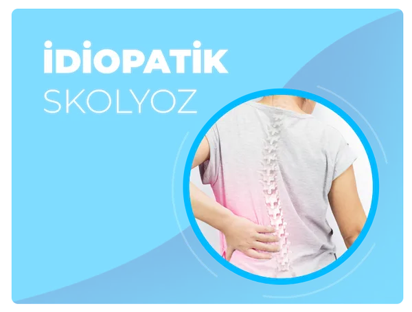 İdiopatik skolyoz tedavi yöntemi ile ilgili makale ve videolar
