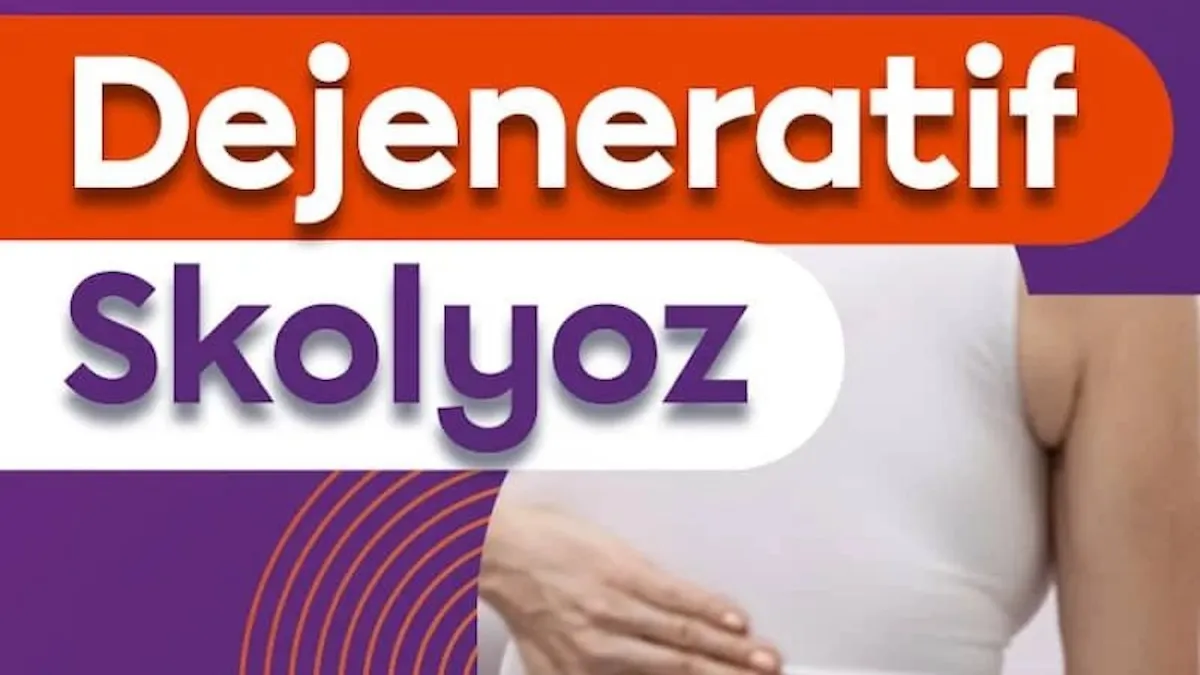 Erişkin skolyozu nasıl anlaşılır, nasıl düzelir