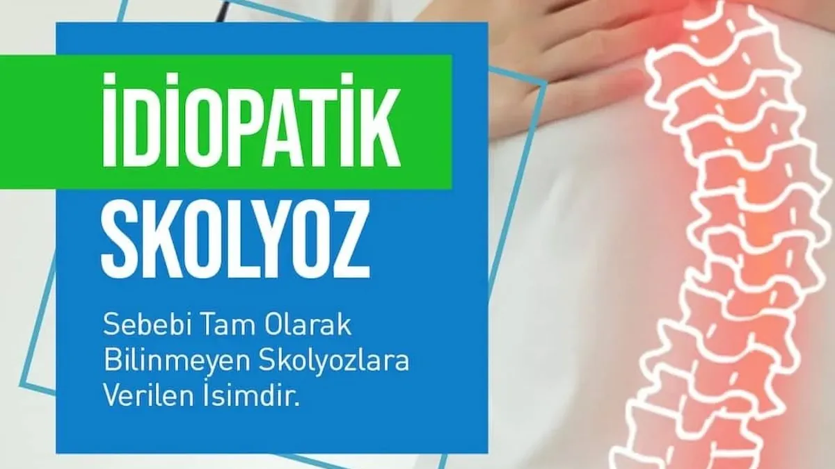 İdiopatik skolyoz ameliyatının avantajları ve riskleri