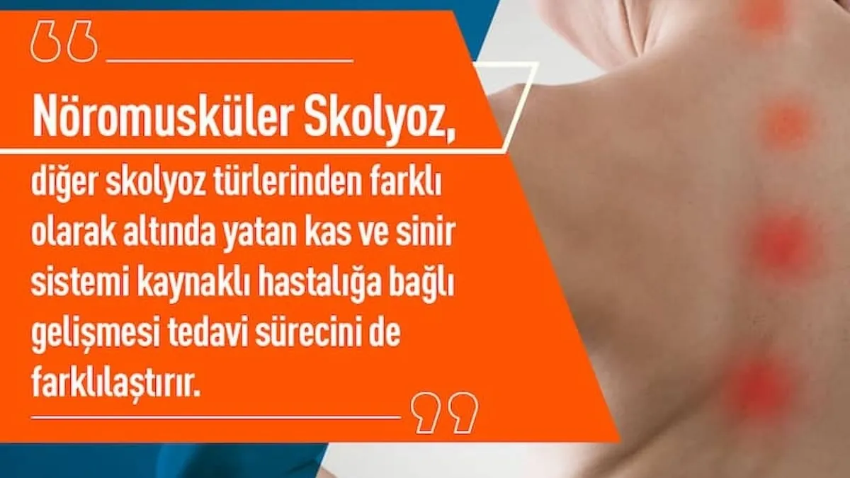 Nöromusküler skolyoz ameliyat yöntemleri