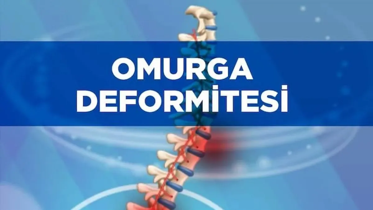 Omurga deformitesinin neden olur