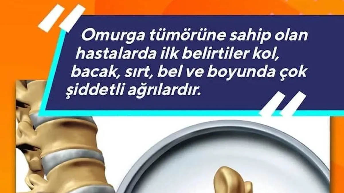 Omurga tümörünün belirtileri nelerdir