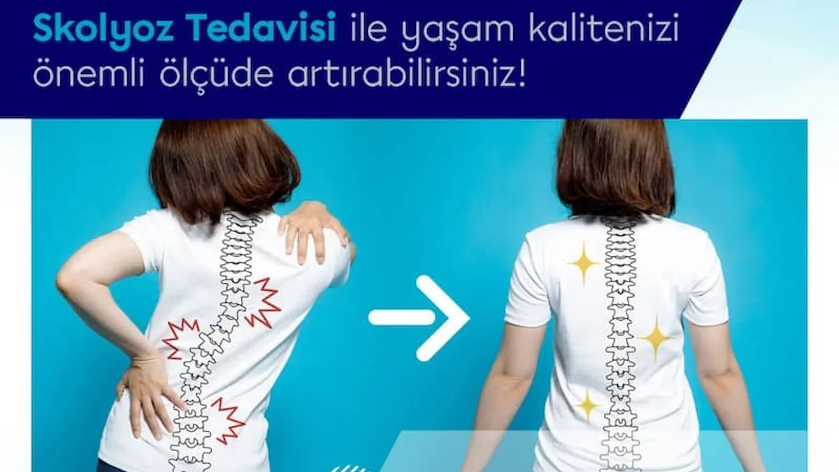 Füzyonlu ve füzyonsuz skolyoz ameliyatı