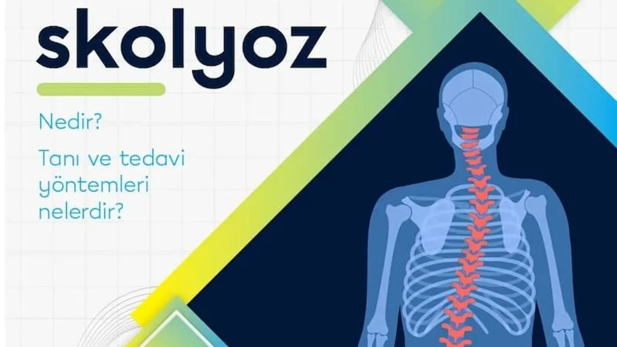 Füzyonlu ve füzyonsuz skolyoz ameliyatı