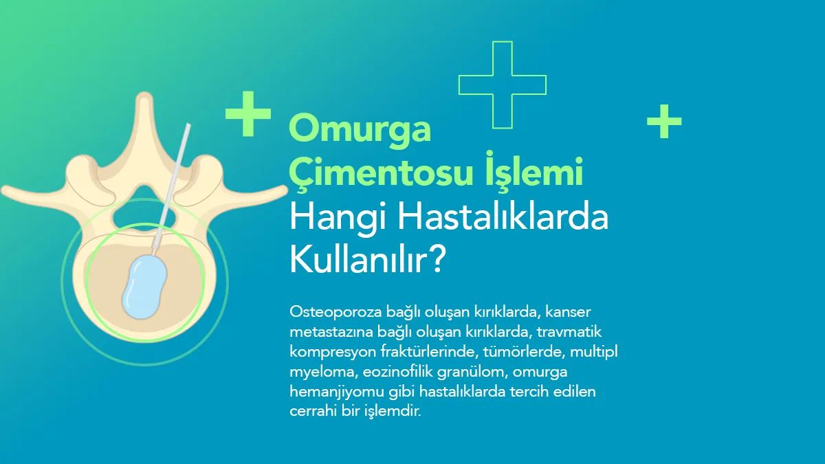 Vertebroplasti Ameliyatı Ne Kadar Sürer?